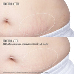 Beija Flor™ Elasti-Body Oil